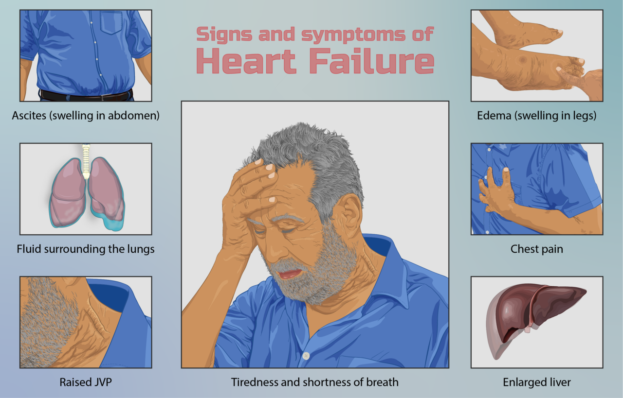BNP and NT-proBNP (nt probnp normal range) —  heart failure explained illustration