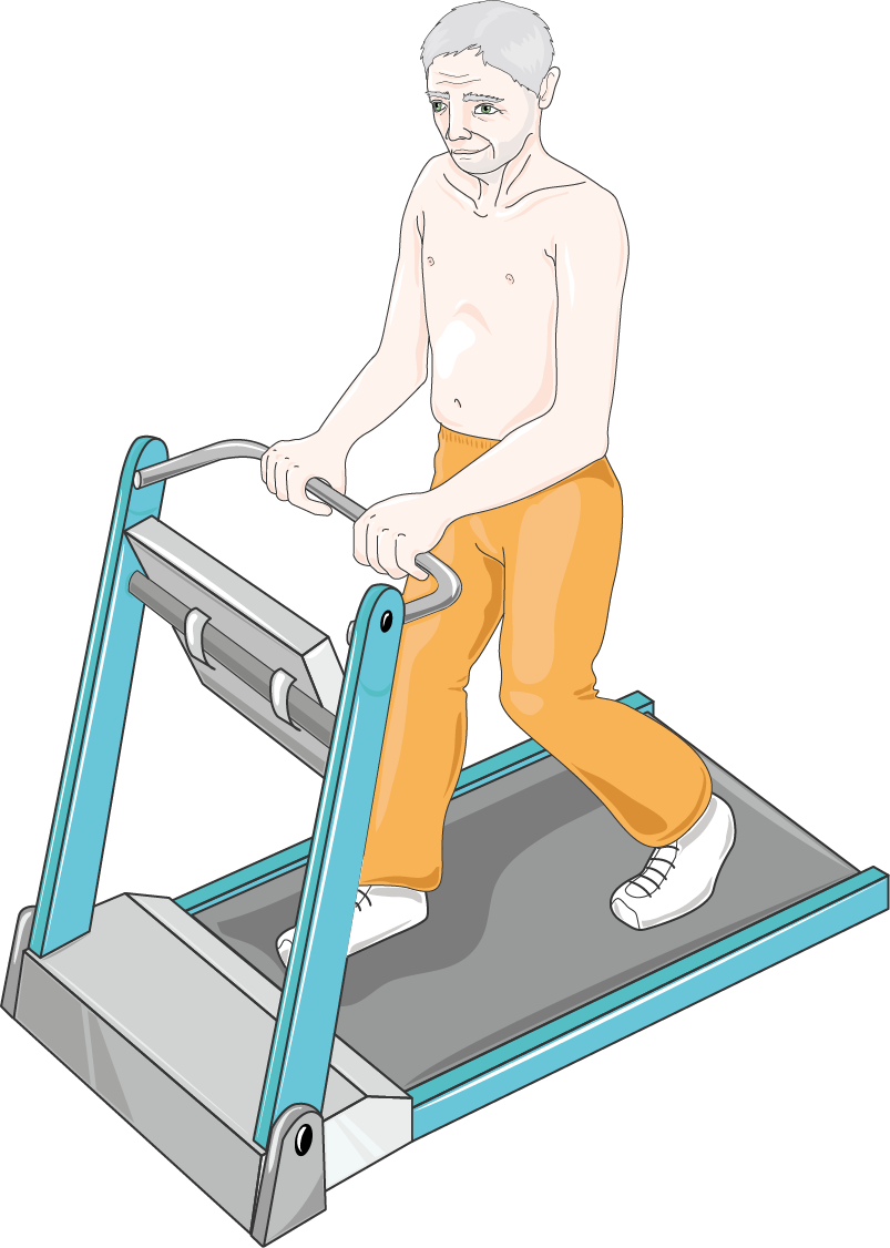 Exercise Stress Test Explained (exercise stress test) — test treadmill explained illustration