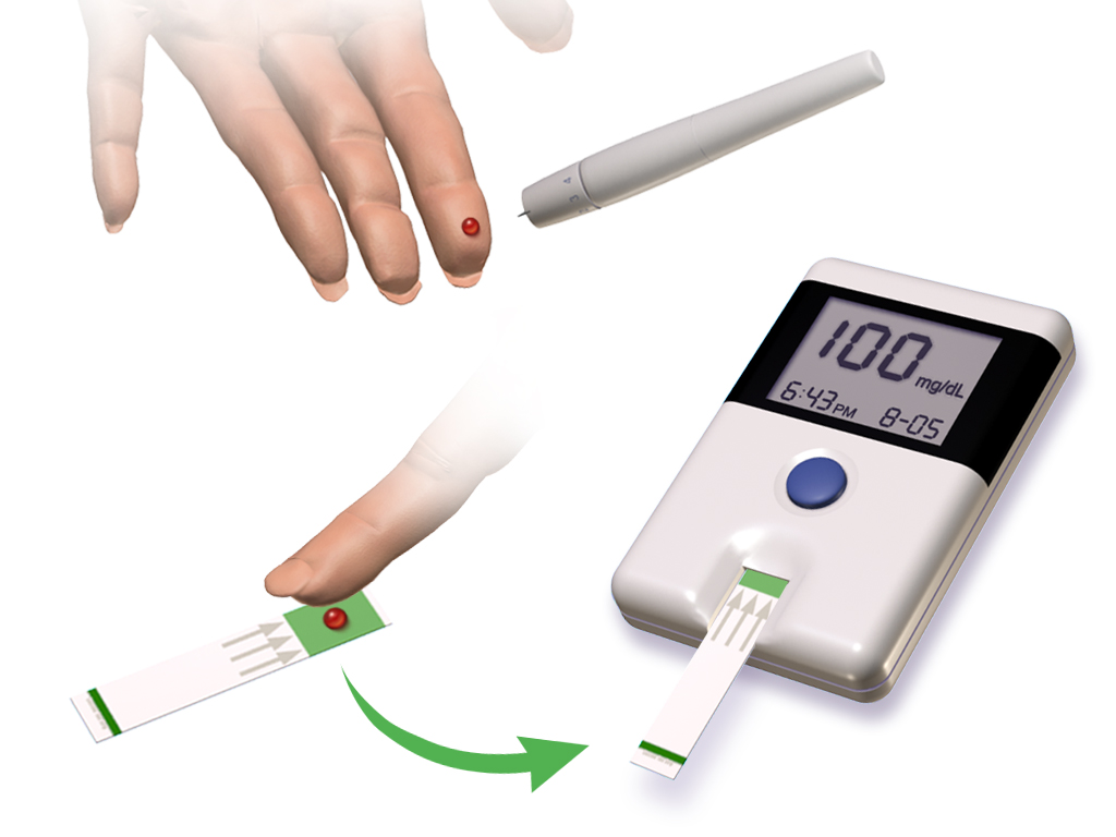 Ferritin Blood Test (ferritin blood test) — ood test low normal high illustration