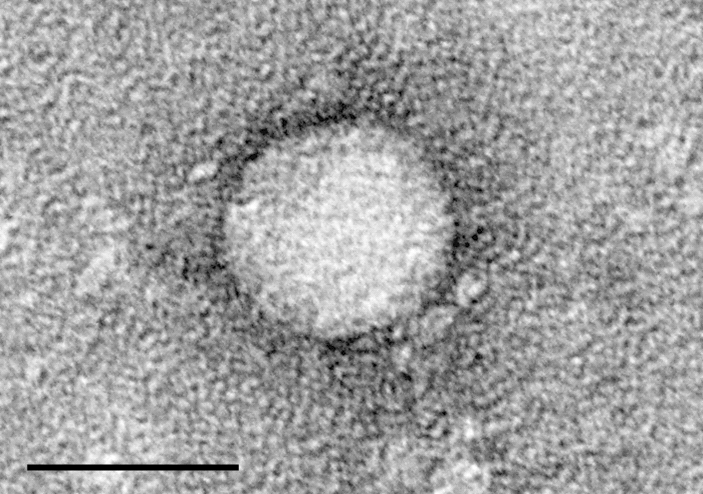 Hepatitis C Antibody Test and HCV RNA (hepatitis c antibody test) —  antibody test explained illustration