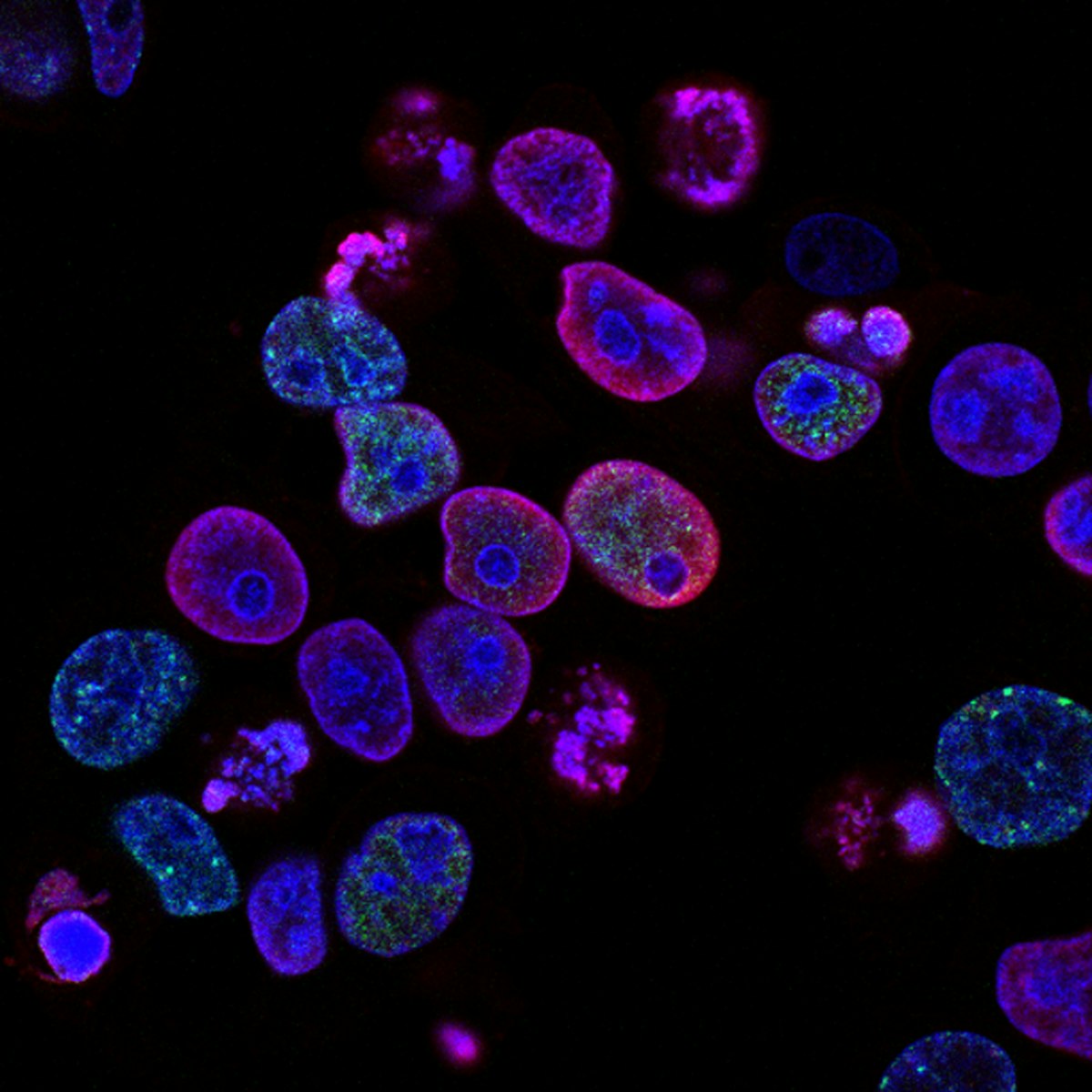 High CRP with Normal ESR (high crp normal esr) — high crp normal esr hero image