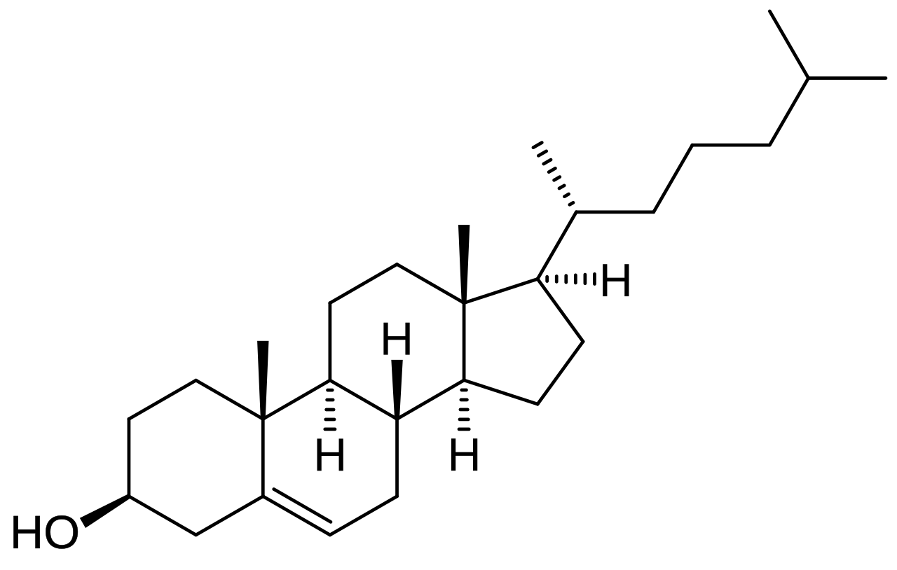 Lipoprotein overview diagram