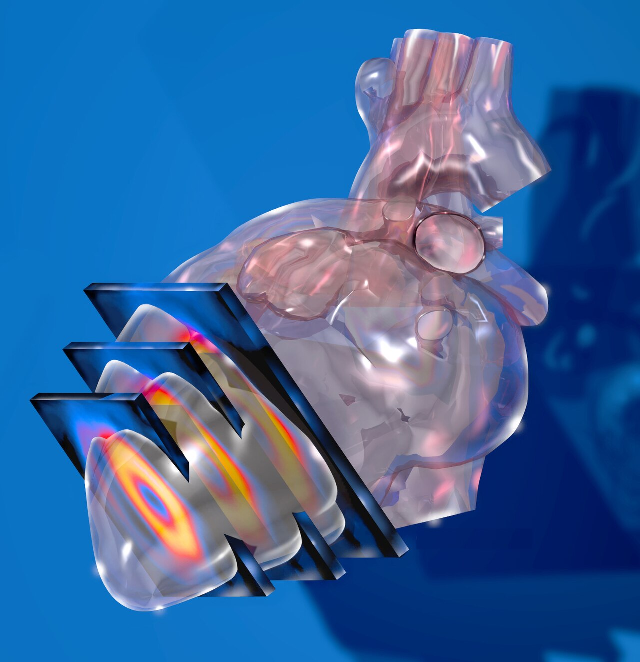 Myocardial Perfusion Imaging (SPECT) Explained (myocardial perfusion imaging) —  imaging spect explained illustration